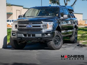 Ford F-150 Enhanced Tow Hook - Aluminum - Black Ford F-150 Enhanced Tow Hook - Aluminum - Black